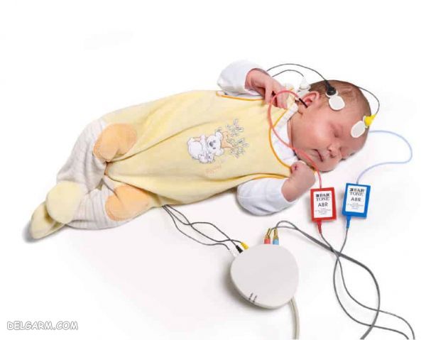 آزمایش شنوایی نوزاد