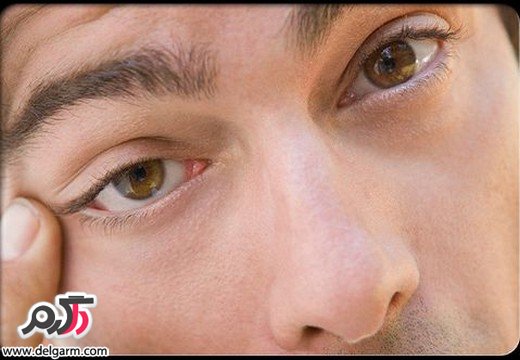 علایم و نشانه های خشکی چشم