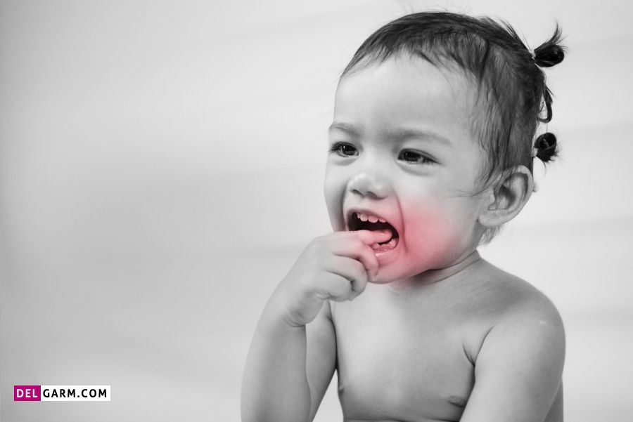 تسکین دندان درد کودک