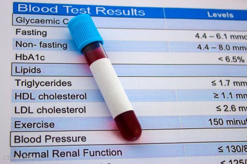 آزمایش ها برای اندازه گیری کلسترول خون