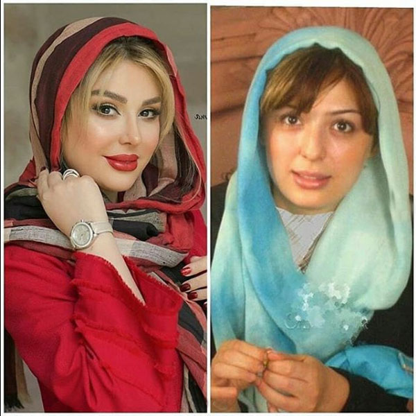 تصاویر دیدنی از قبل و بعد بازیگران ایرانی