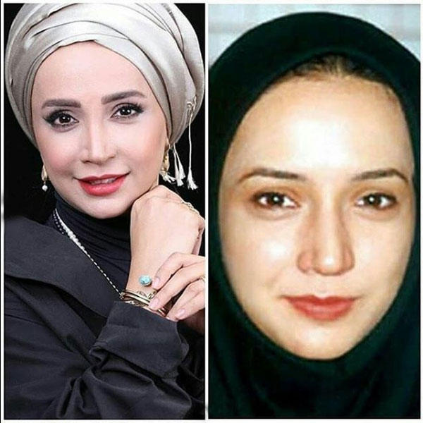 تصاویر دیدنی از قبل و بعد بازیگران ایرانی