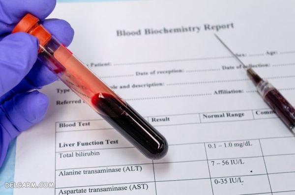 Triglyceride در آزمایش خون