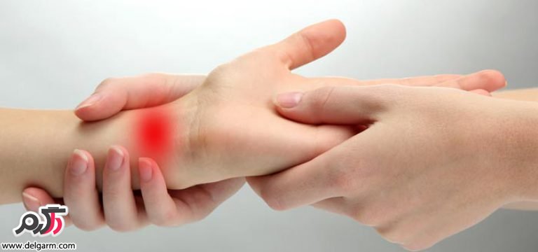  تشخیص و درمان بیماری دکرون در مچ دست چگونه است