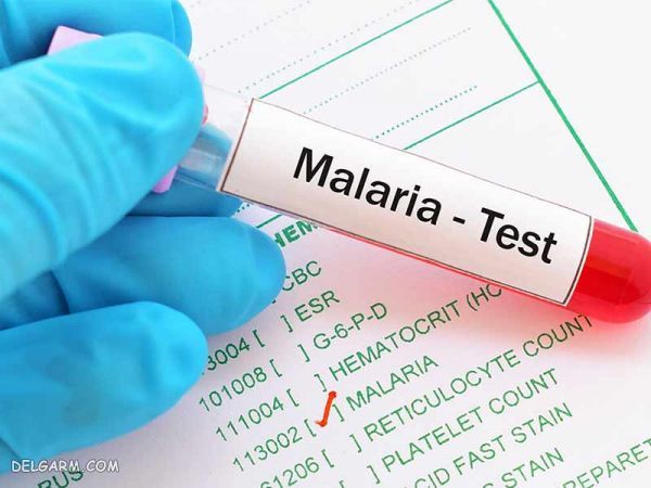 روش های تشخیص بیماری مالاریا