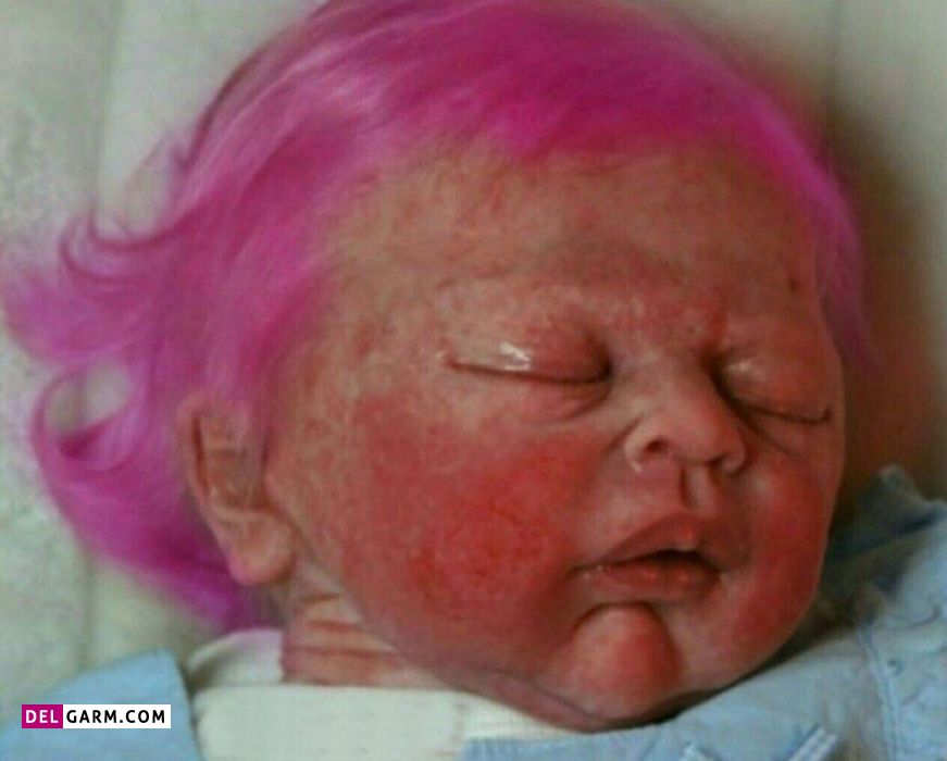 چرا نباید موی کودک را رنگ کنیم؟