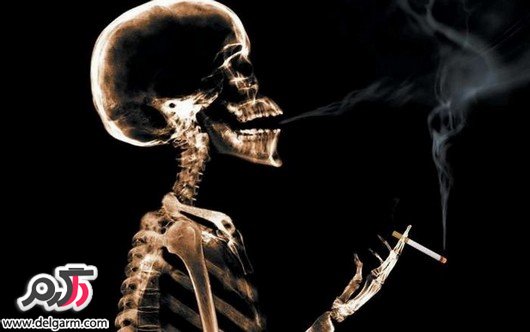بدترین آسیب های سیگار بر ظاهر