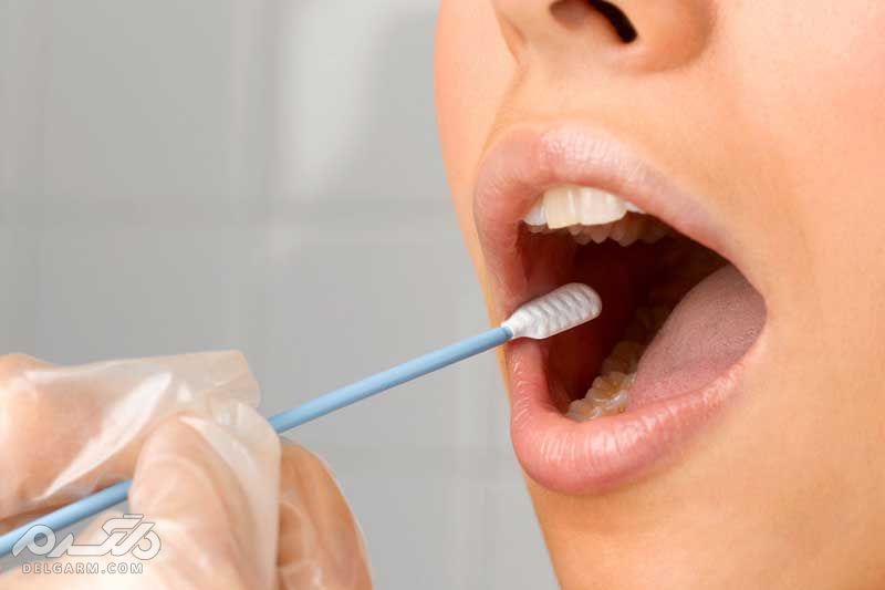 علت شیرین شدن دهان چیست؟