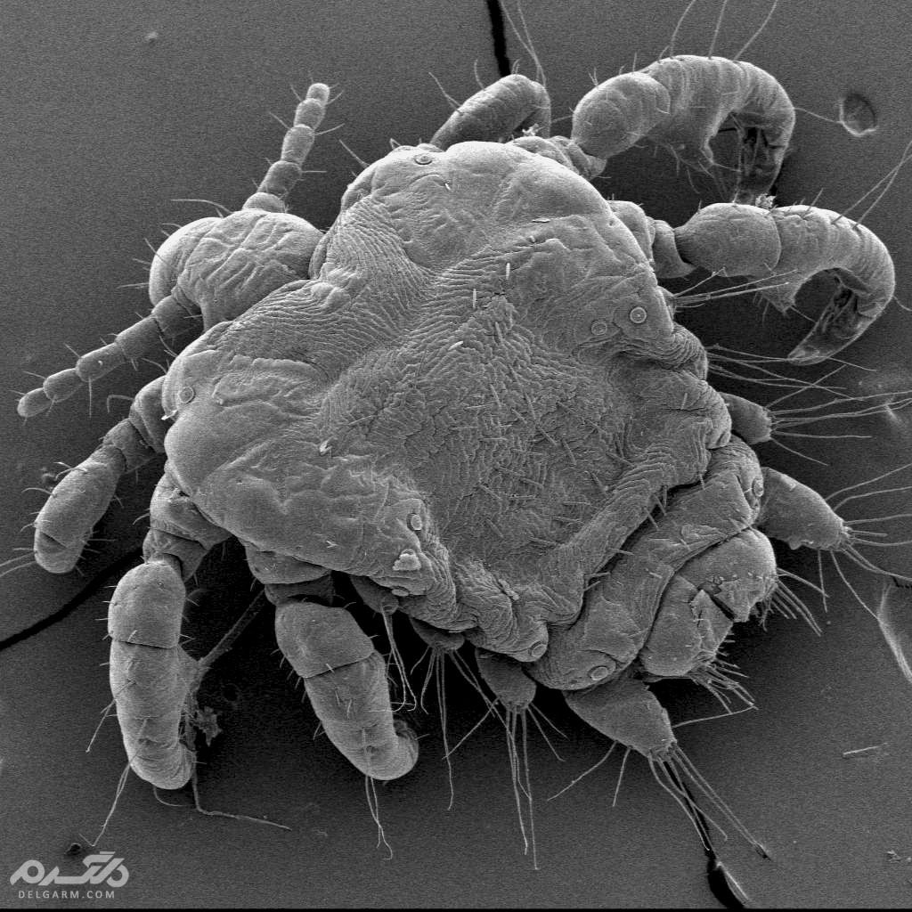 تصویر میکروسکوپی شپش عانه