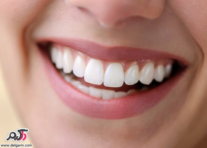 ده علت تغییر رنگ دندان‌ها 