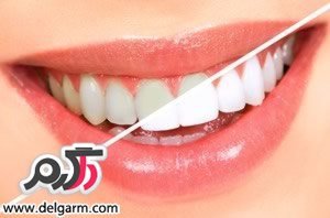 علت لق شدن دندان بزرگسالان چیست؟