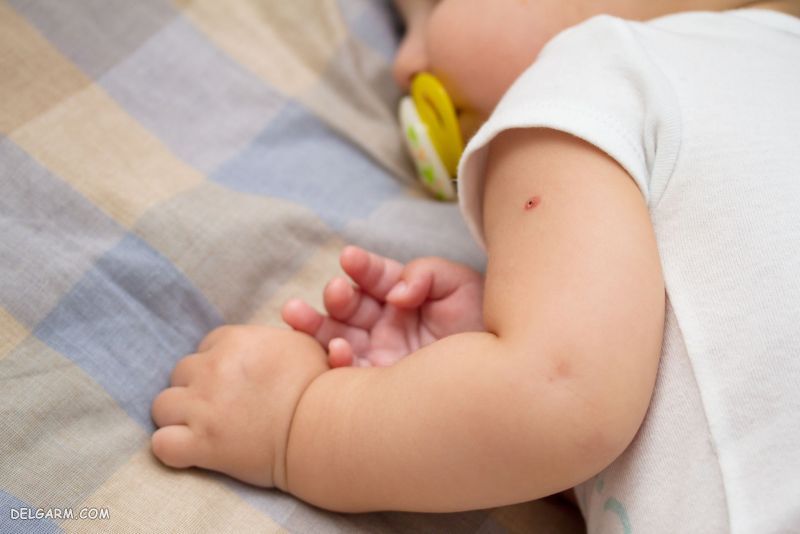 مراقبت های واکسن 18 ماهگی