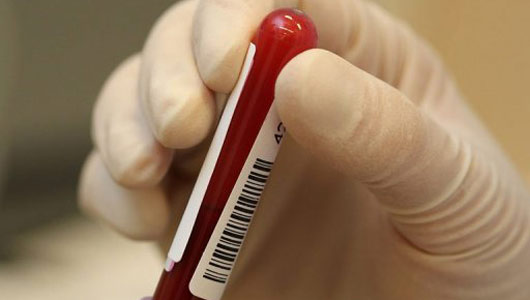 پیش بینی طول عمر انسان با آزمایش خون