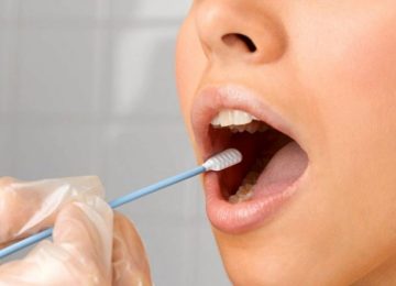 ۱۸ علت اصلی غلیظ شدن بزاق دهان چیست ؟_5dcceb445ef3e.jpeg